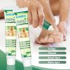 Sumifun Vitiligo Cream Reduces White Spots and Improves Skin Pigmentation 20gram