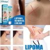 South Moon Lipoma Removal Cream Lipolysis Fat Lump Relieve Plaster Skin Swelling Ointment Subcutaneous Lumps Dredge Dissipate Body Care（20g）