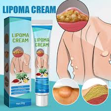 South Moon Lipoma Removal Cream Lipolysis Fat Lump Relieve Plaster Skin Swelling Ointment Subcutaneous Lumps Dredge Dissipate Body Care（20g）