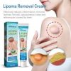 South Moon Lipoma Removal Cream Lipolysis Fat Lump Relieve Plaster Skin Swelling Ointment Subcutaneous Lumps Dredge Dissipate Body Care（20g）